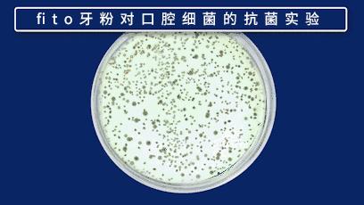 去除黄牙牙垢的牙膏,去口臭黄牙牙垢的牙膏