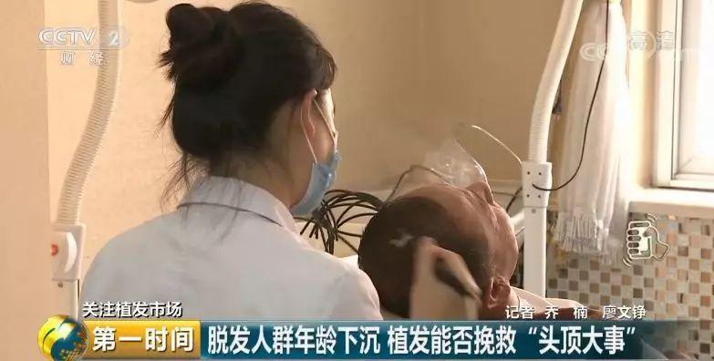 头顶脱发植发有用吗,中国脱发人数2024
