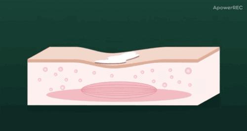 欧姆龙便携式按摩器,欧姆龙按摩仪f021和f022的区别