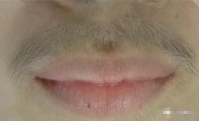 女人竟然长了胡子,女孩子长胡子用脱毛膏