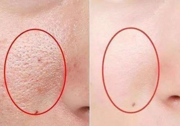 这个乳胶枕太强了！止鼾、防螨虫，全家适用的睡眠伴侣