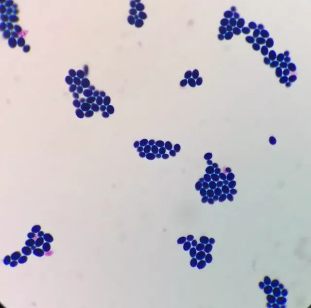 儿童大便里有霉菌的治疗,小孩粪便检查出霉菌