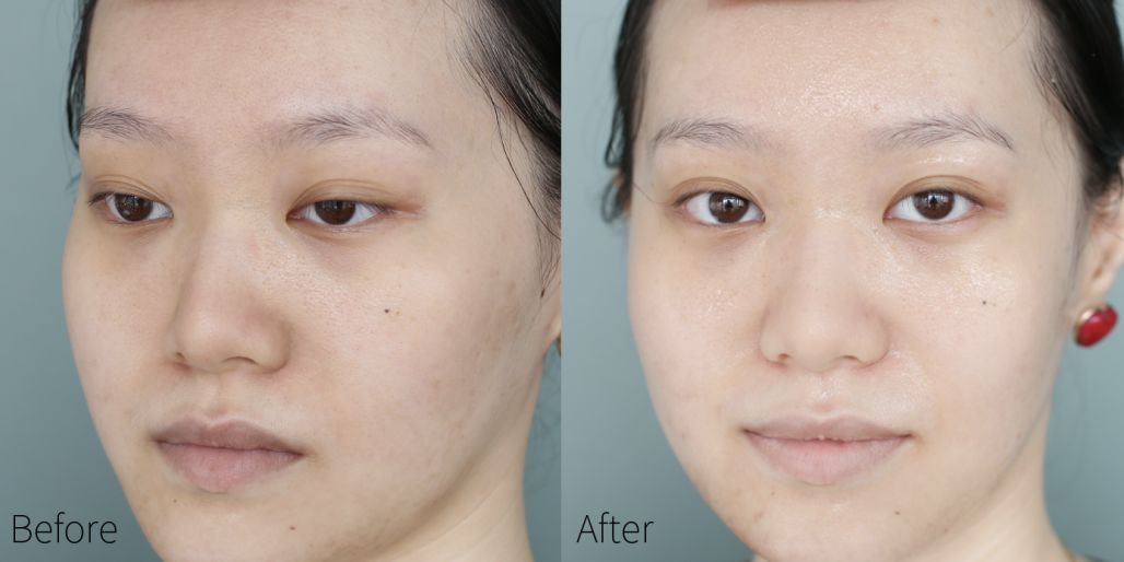 蒂佳婷dr.jart水光蓝丸pro面膜,韩国drjart蒂佳婷黑色面膜要洗吗