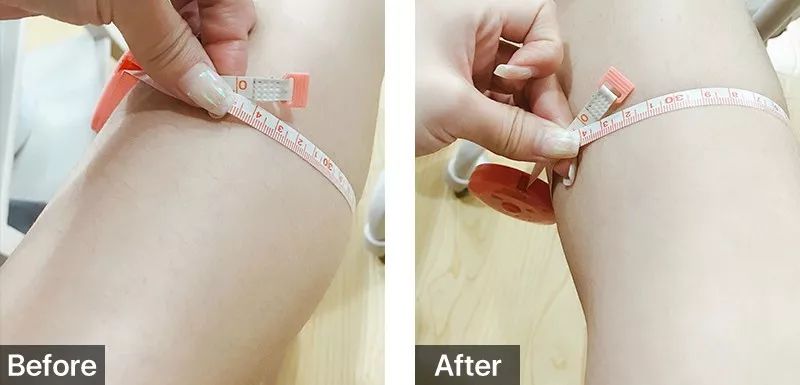 跑完步脚底板很痛但没有起泡,跑完步脚底板一踩就疼怎么回事