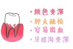 20岁牙周炎牙齿掉光了 (牙齿都掉光了牙周炎是不是就好了)