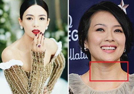 这款急救弹性蛋白贴，每天一片赶走干纹，还你天鹅美颈