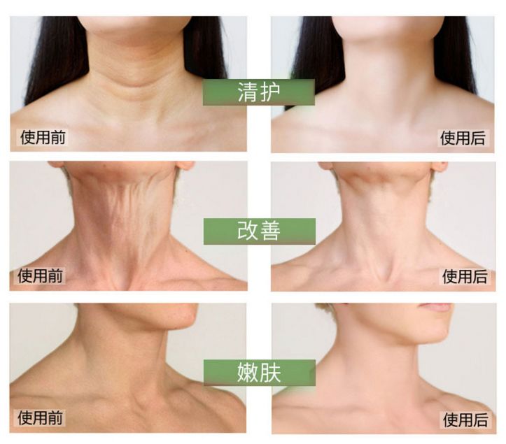 蛋白贴去皱,胶原蛋白颈纹贴