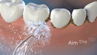 9成中国人没见过，洗牙就用1分钟，美国人用了很久的洁牙神器