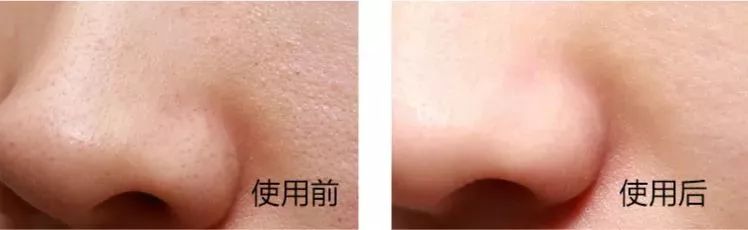 欧莱雅火山控油洗面奶什么时候用,欧莱雅男士洗面奶火山岩控油祛痘