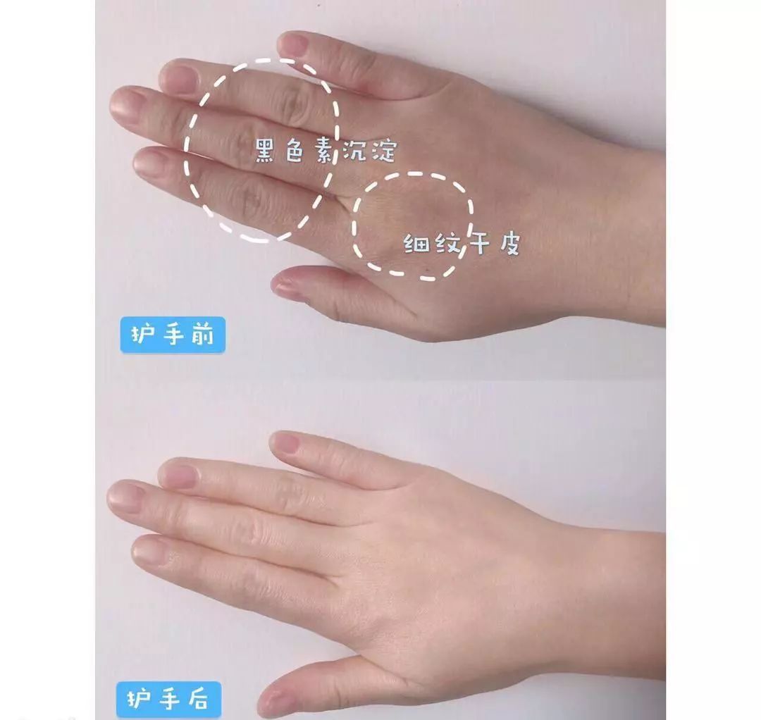 神奇绵羊油,润肤用的绵羊油