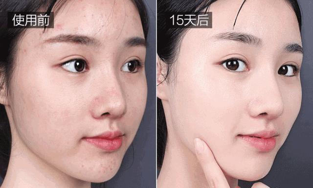 长期补充胶原蛋白的人怎么样了,长期喝胶原蛋白的人最后怎么样了