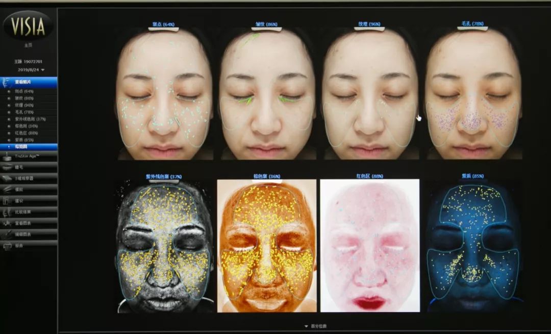 肌诊室水光肌挑战,肌诊室修复