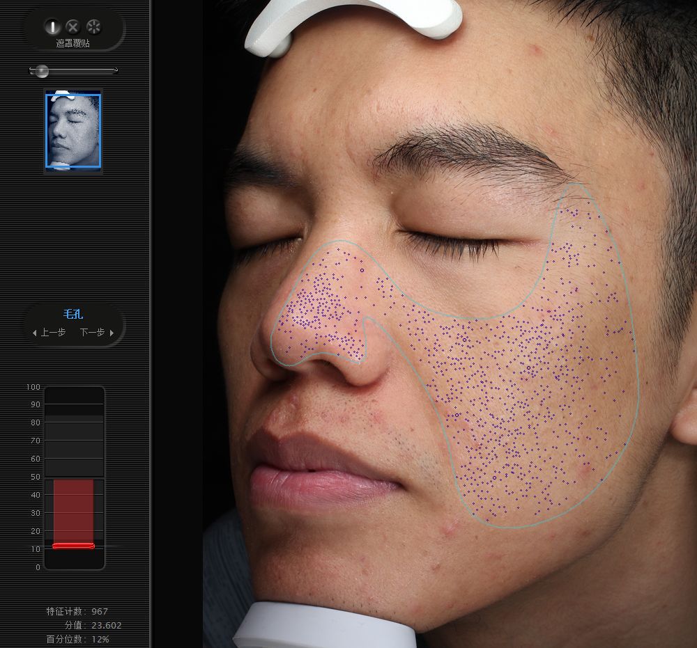 五周年福利｜皮肤“照妖镜”VISIA免费体验！定制你的皮肤管理方案，浙大四院五周年福利持续放送中