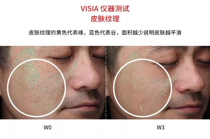 同样的年龄有的年轻人有的人老,同样的年龄为何他却比你显得年轻