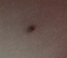 祛斑首选护肤品,祛斑最好的克星