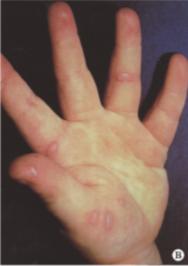 好书推荐｜《皮肤病彩*图色**谱》（第4版）