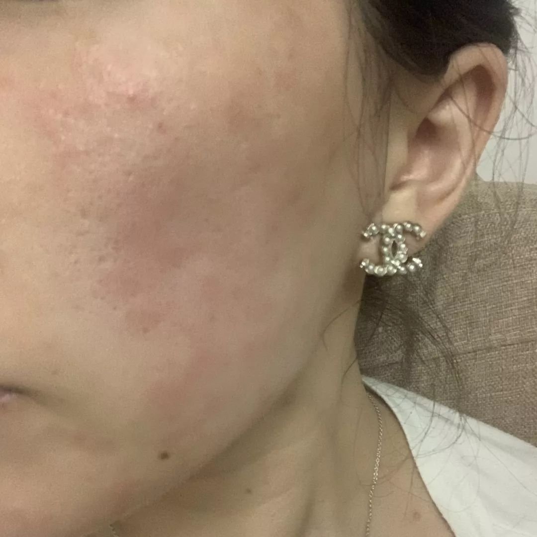 粉丝给我出了个难题该怎么办,美容院把脸整坏了在哪投诉