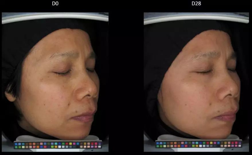 真正变白变美的方式竟然是这样,5个变白小技巧