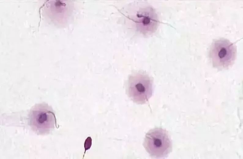 男性孕前检查前注意事项,男性孕前检查有什么注意事项