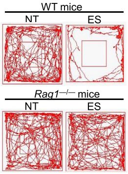 《细胞》：压力竟会压碎T细胞的线粒体！中国科学家发现，压力会破坏CD4+T细胞线粒体，导致代谢紊乱，波及大脑引起焦虑丨科学大发现