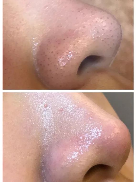 1元体验“爱马仕”级的变美服务，限量100份，再不抢就没了