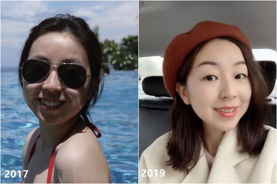 最短只要一年，这件事做对了堪比整容