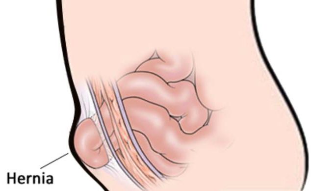 勿以病小而不医勿以病大而自弃,勿以小而不为