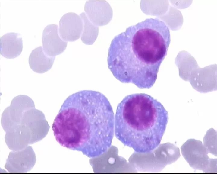 全血细胞减少疾病，你还傻傻分不清？