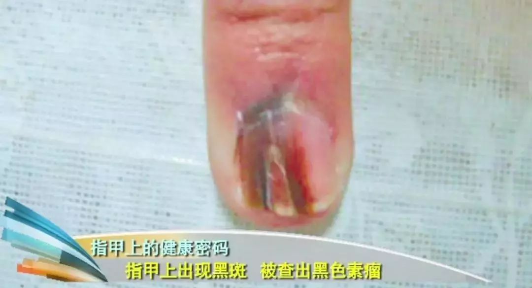 科普指甲怎么来的,关于指甲的科普视频