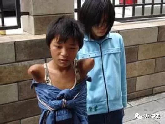 眼球被挖的人后续,眼球被挖了之后眼皮还能睁开吗