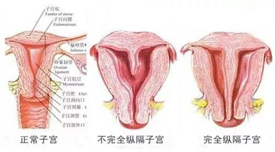 雅安恒博医院看妇科好不好,雅安恒博医院会摘除子宫吗