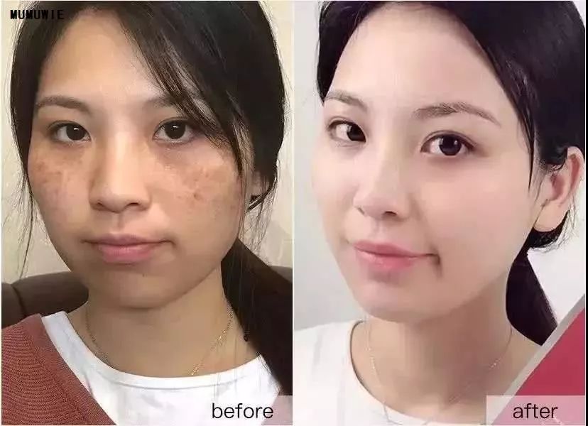 一招改善肩部疼痛,4个方法缓解肩周疼痛