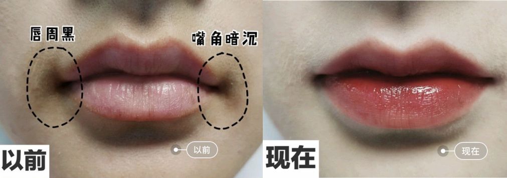 脸上搓出3斤泥！难怪又黄又暗又黑头！10秒给脸蛋“剥壳”，厉害