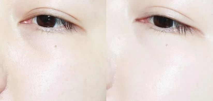 卡粉起皮怎么补救没有面霜和水乳,卡粉起皮怎么补救油皮