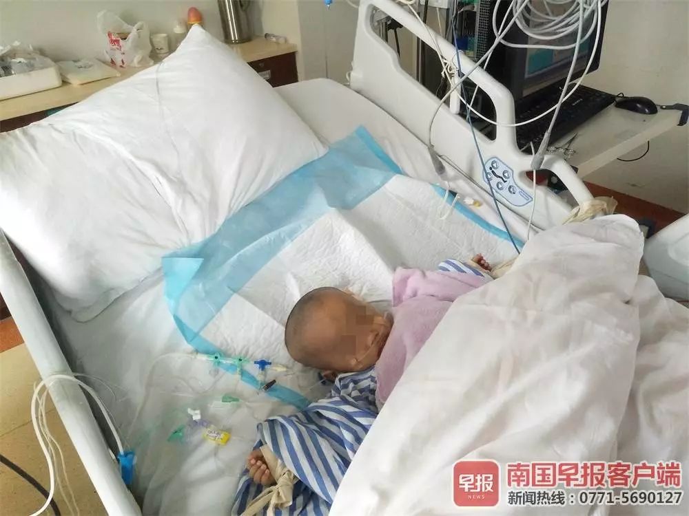 47天男婴患怪病,怪病男孩广西