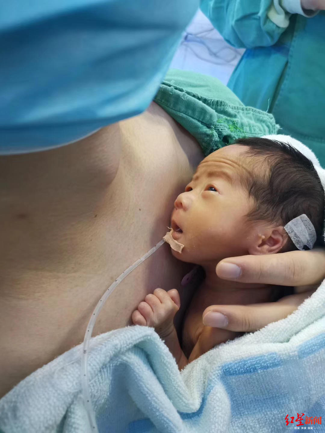 袋鼠抱婴儿原视频,袋鼠抱早产儿要多和宝宝说话