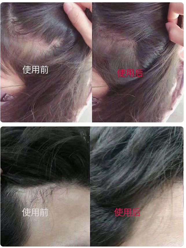 防脱发的生姜洗发水安利,官方推荐防脱洗发水