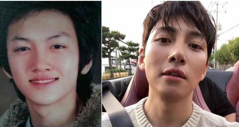 韩国明星谈整容,韩国明星整容失败