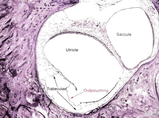 22张图，细说梅尼埃病的组织病理学特点丨“晕”筹帷幄