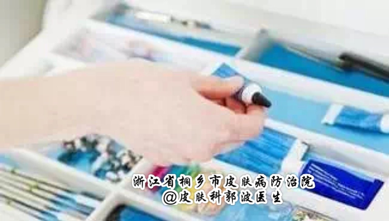 湿疹冷敷的正确方法,如何正确认识湿疹