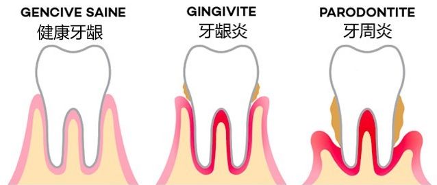 「学习」欢迎来到留学菌的法语小课堂