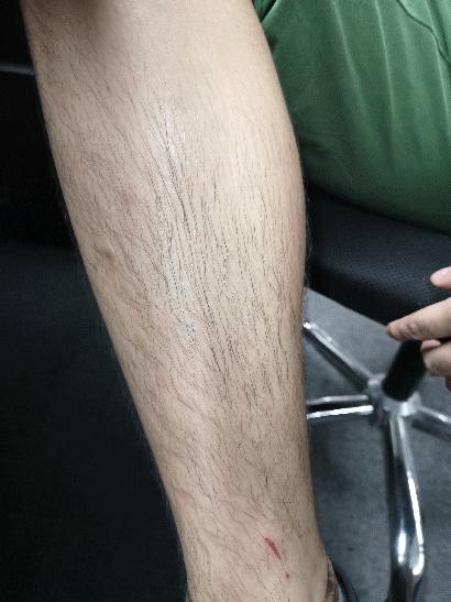 永久脱毛膏既好用又便宜,脱毛膏好用还是刮毛刀好用呢