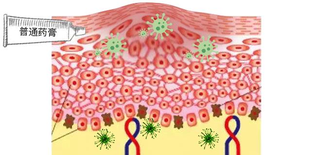 长小水泡很痒用什么中药,皮肤止痒起包用哪个药膏
