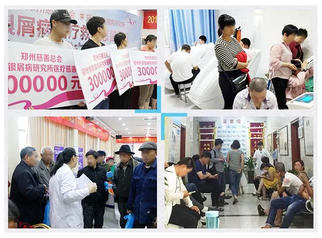 河南牛皮癣国家补贴标准,河南有牛皮癣慢性病补助吗