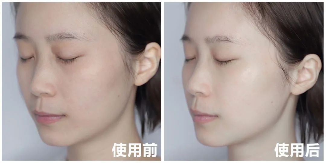 各类肌肤的实用美白技巧,美白牛奶肌的秘密在这里