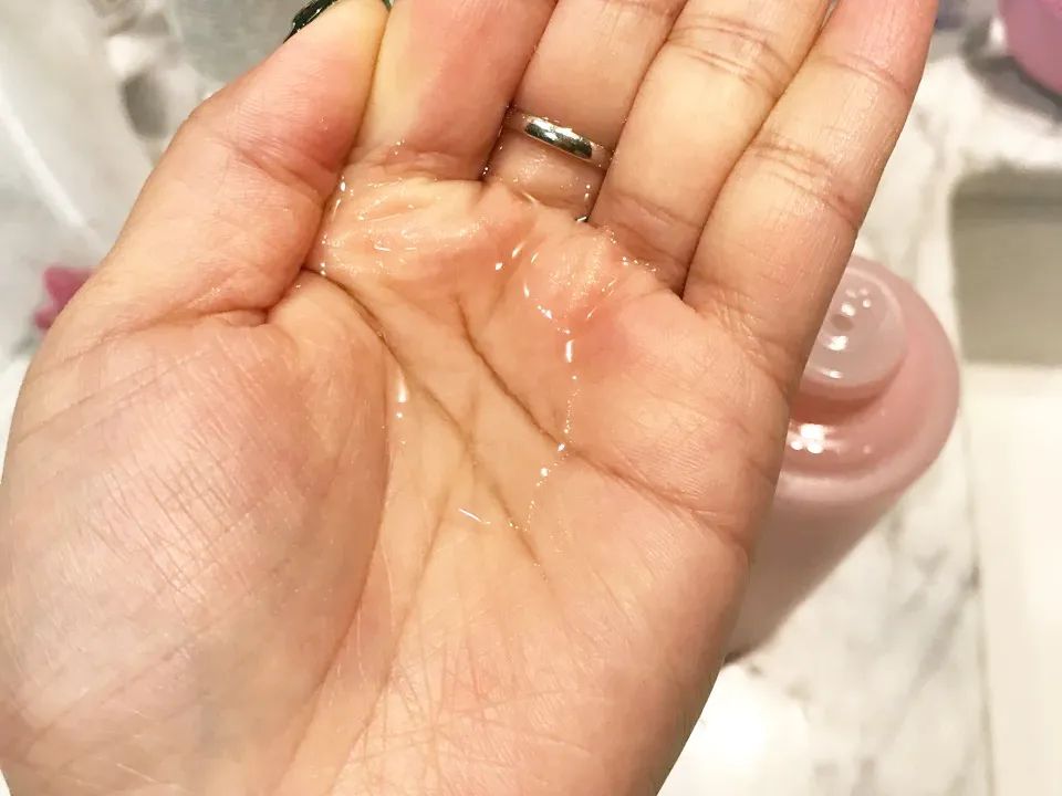 100个皮肤问题案例,世界上十大皮肤顽疾