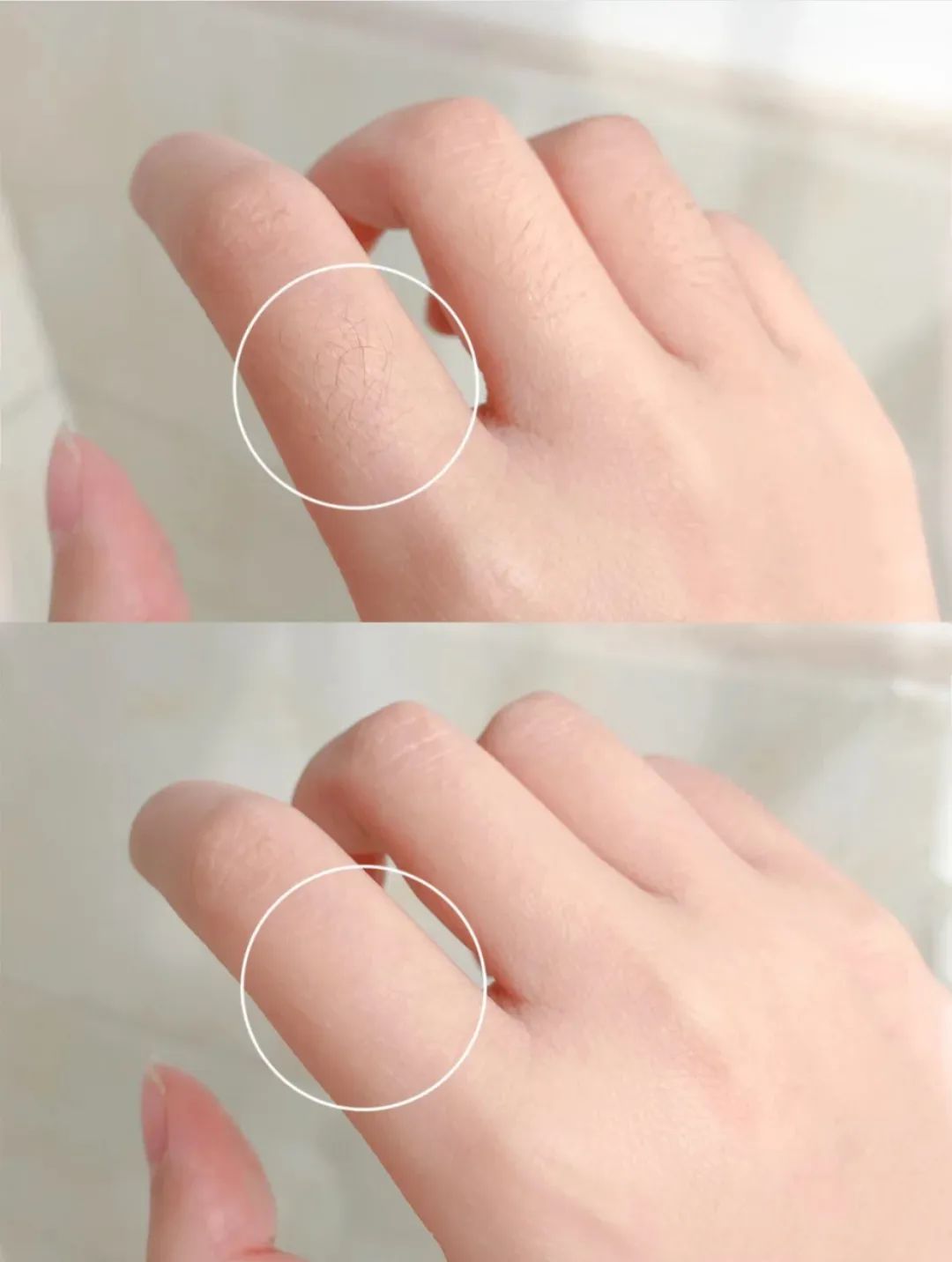 光滑无暇|黑丑的“毛裤腿”，用它，10分钟“脱”得一干二净，肌肤光滑细腻