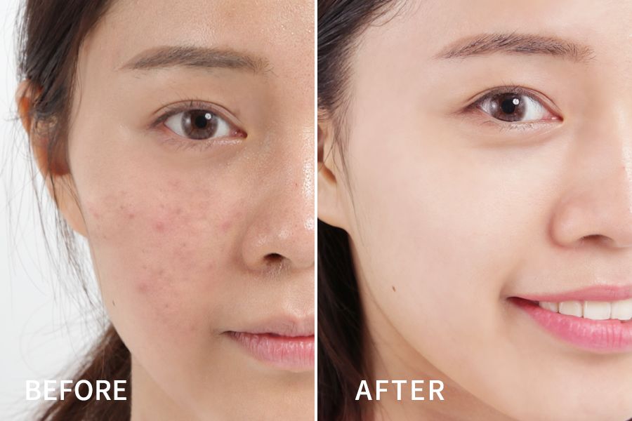 lamer海蓝之谜精华面霜30毫升,lamer海蓝之谜最便宜的单品