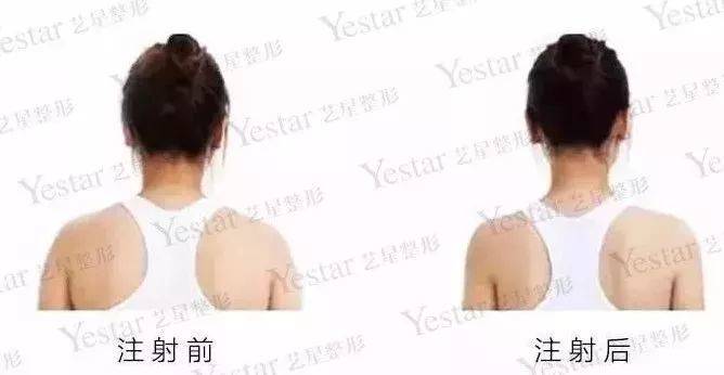 鐦﹁劯鐦﹁吙鐦﹁偐鐦﹁韩,濂界墿鎺ㄨ崘鍑忚偉鐦﹁韩鍙樼編