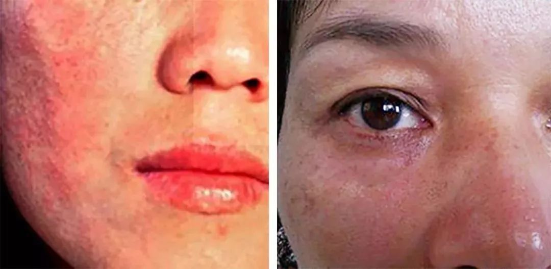 日本防晒帽孙俪,孙俪同款日本防晒帽哪个颜色好看